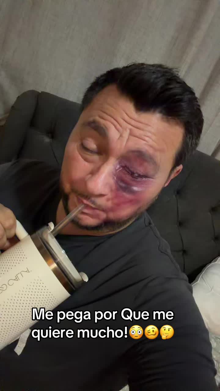 @Las LocurasdeTo&ntilde;o