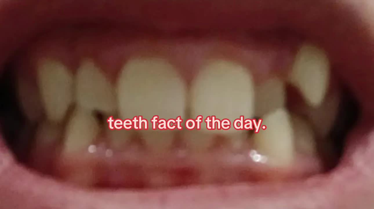 @I leik teeth moer thna mysefl.