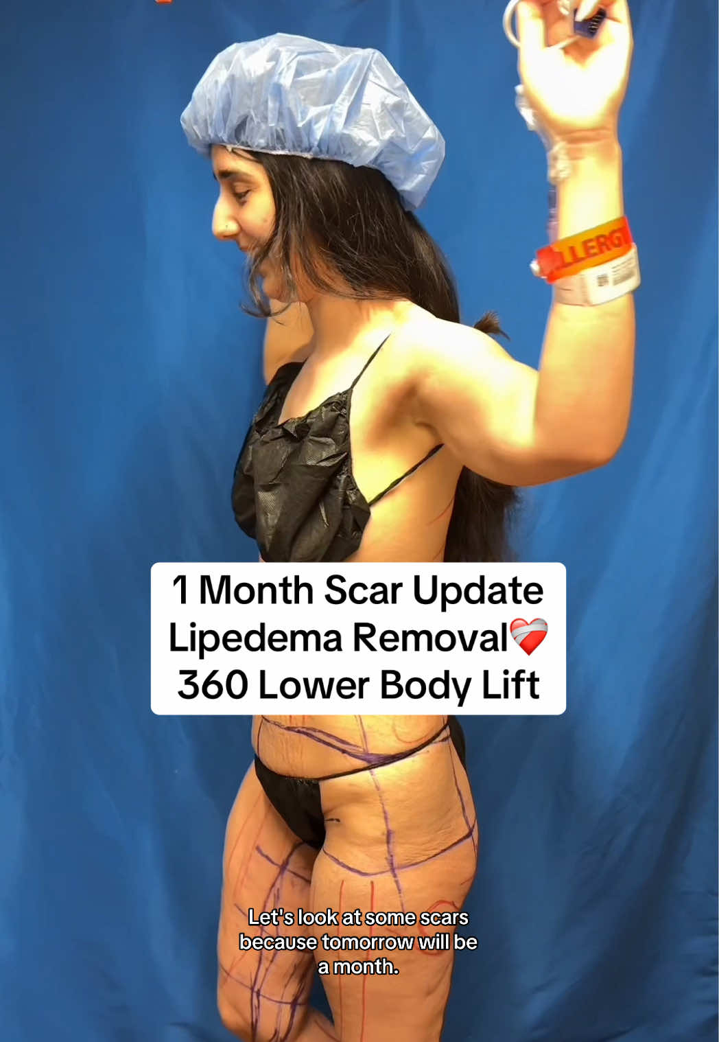@Heather 𖤓 PCOS Princess