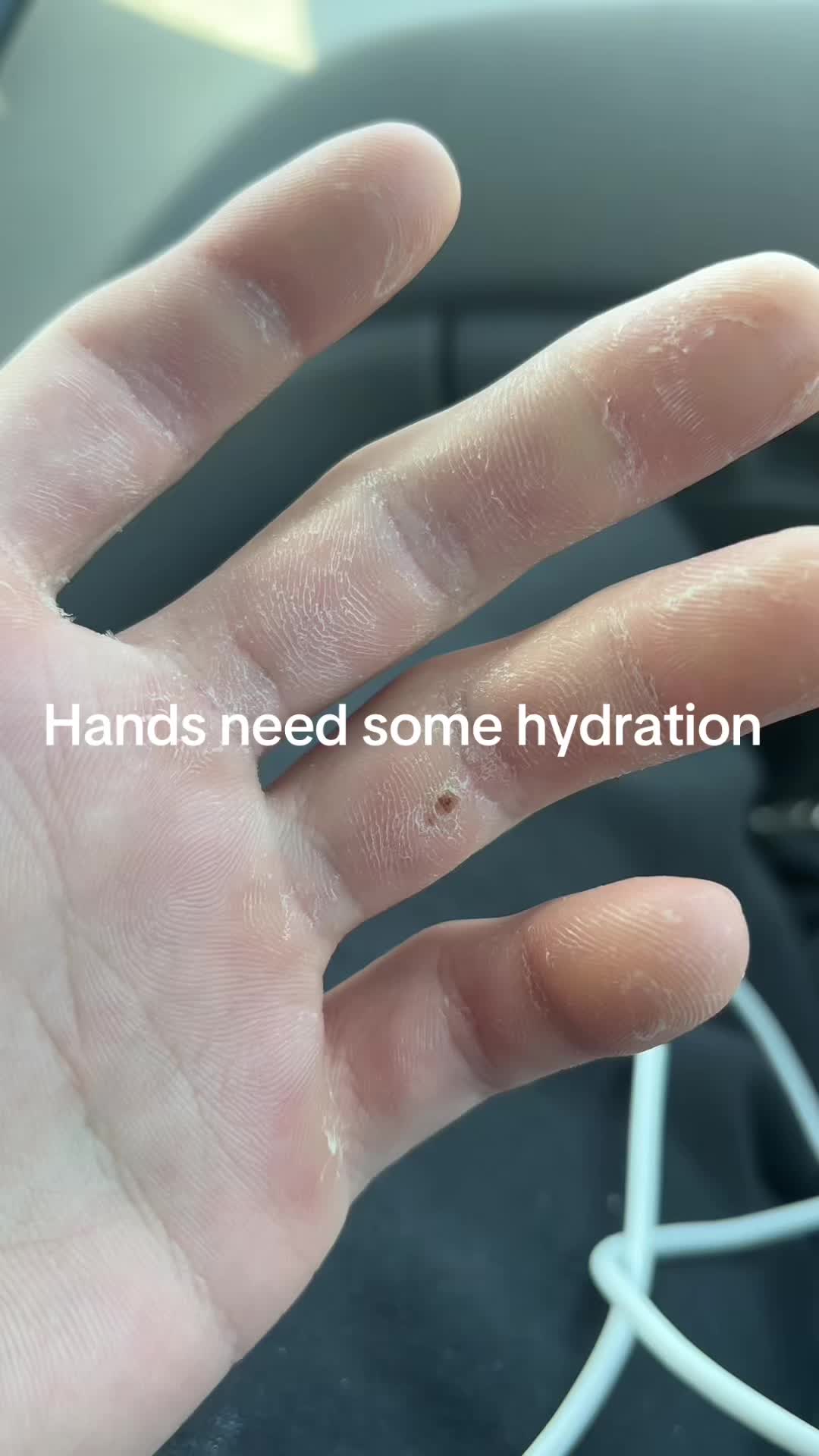 @SpidaClimber