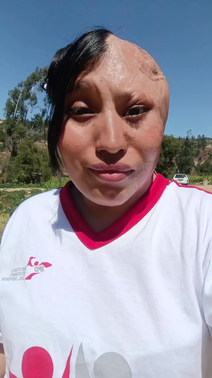 @Elizabeth Carri&oacute;n