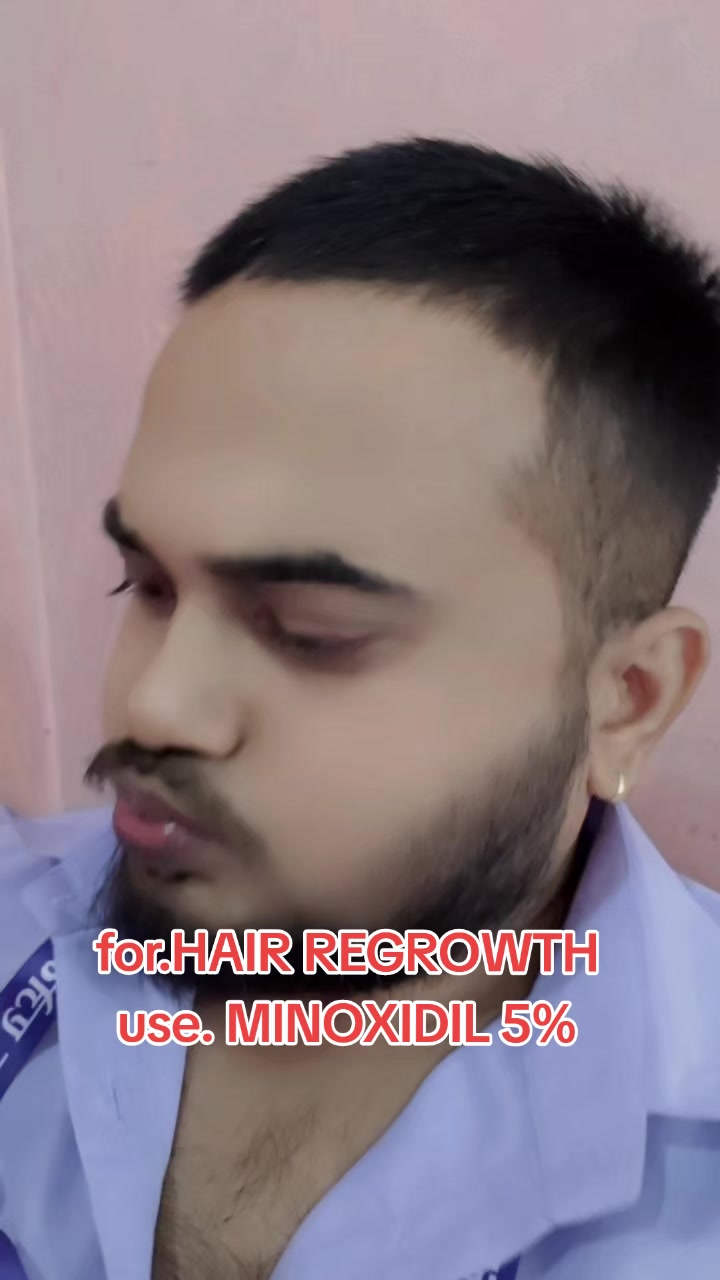 @DipeshSingh. 🕸🕷