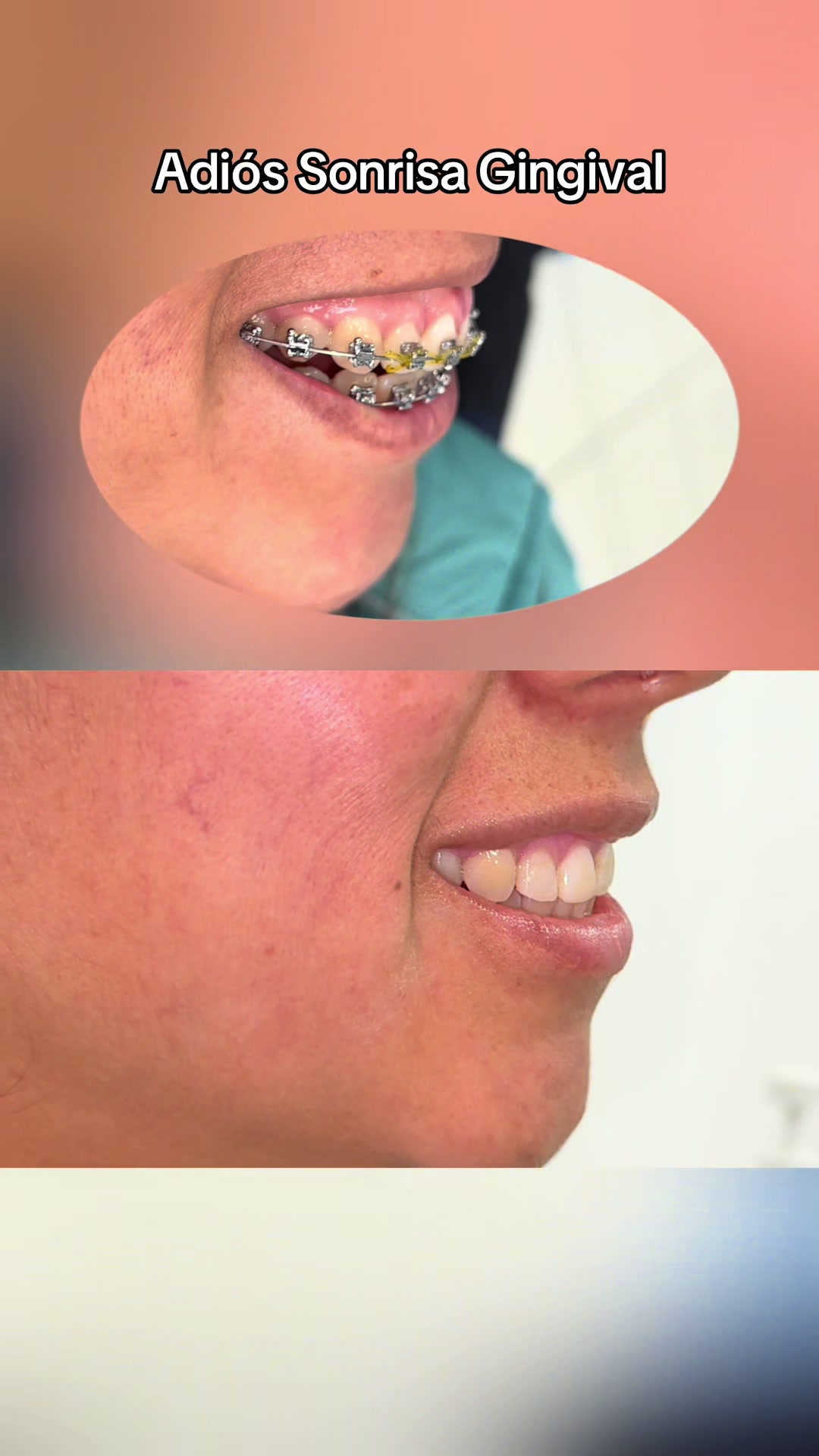 @DentikaBrackets