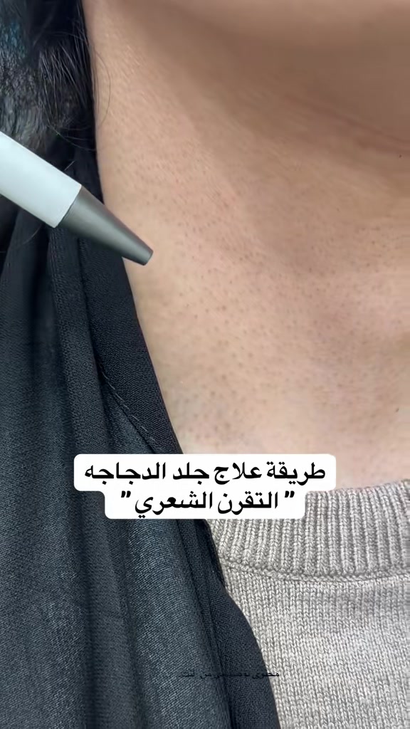 @د. ظافر آل حافظ