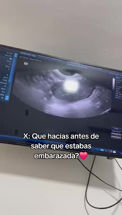 @Erika Santamaria 😛