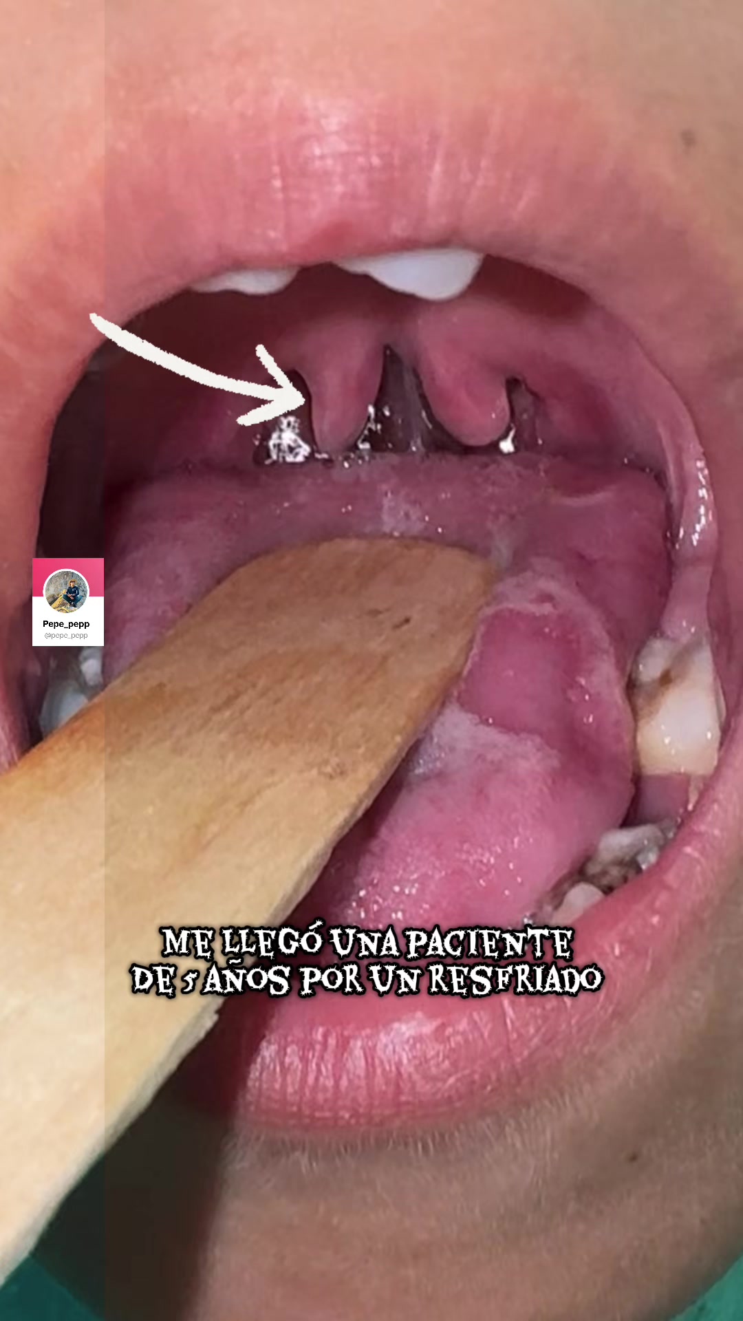 @Pepe_pepp