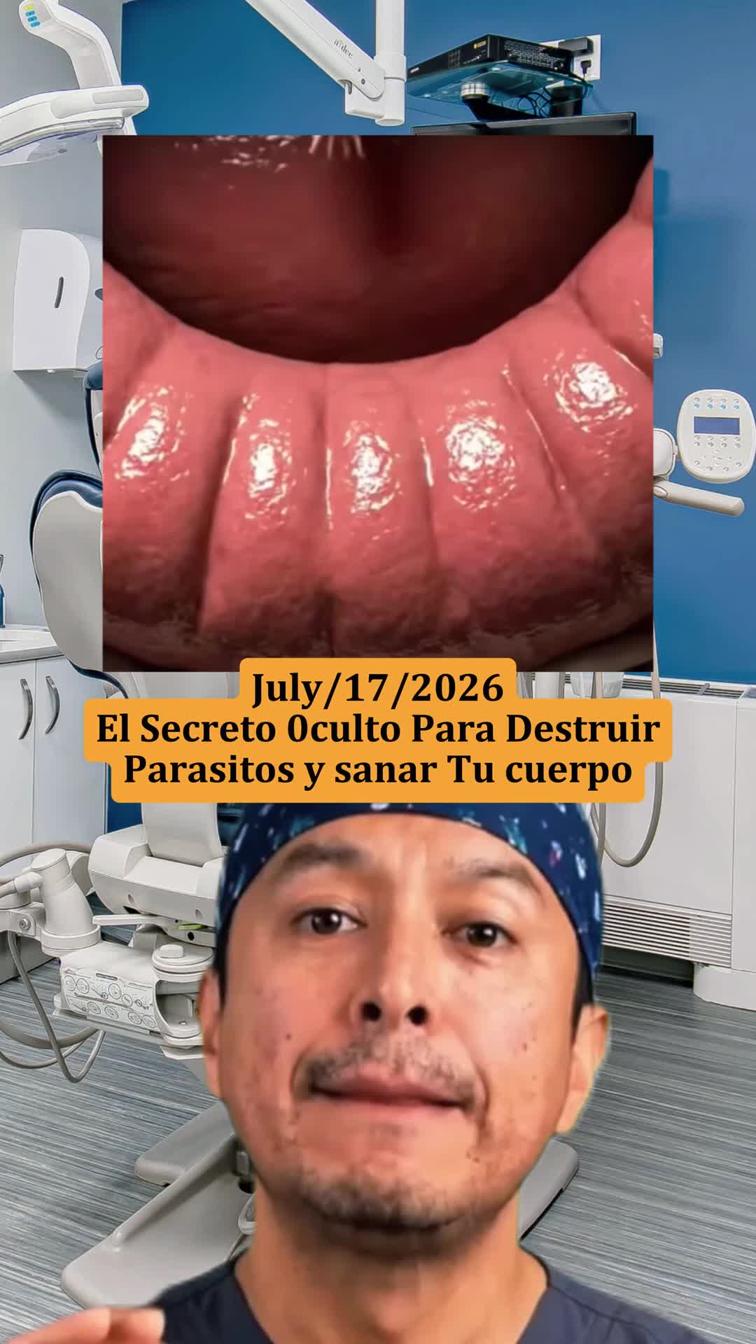 @b11uacmo