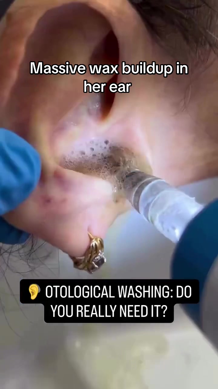 @Satisfying Ear Cleaning Videos