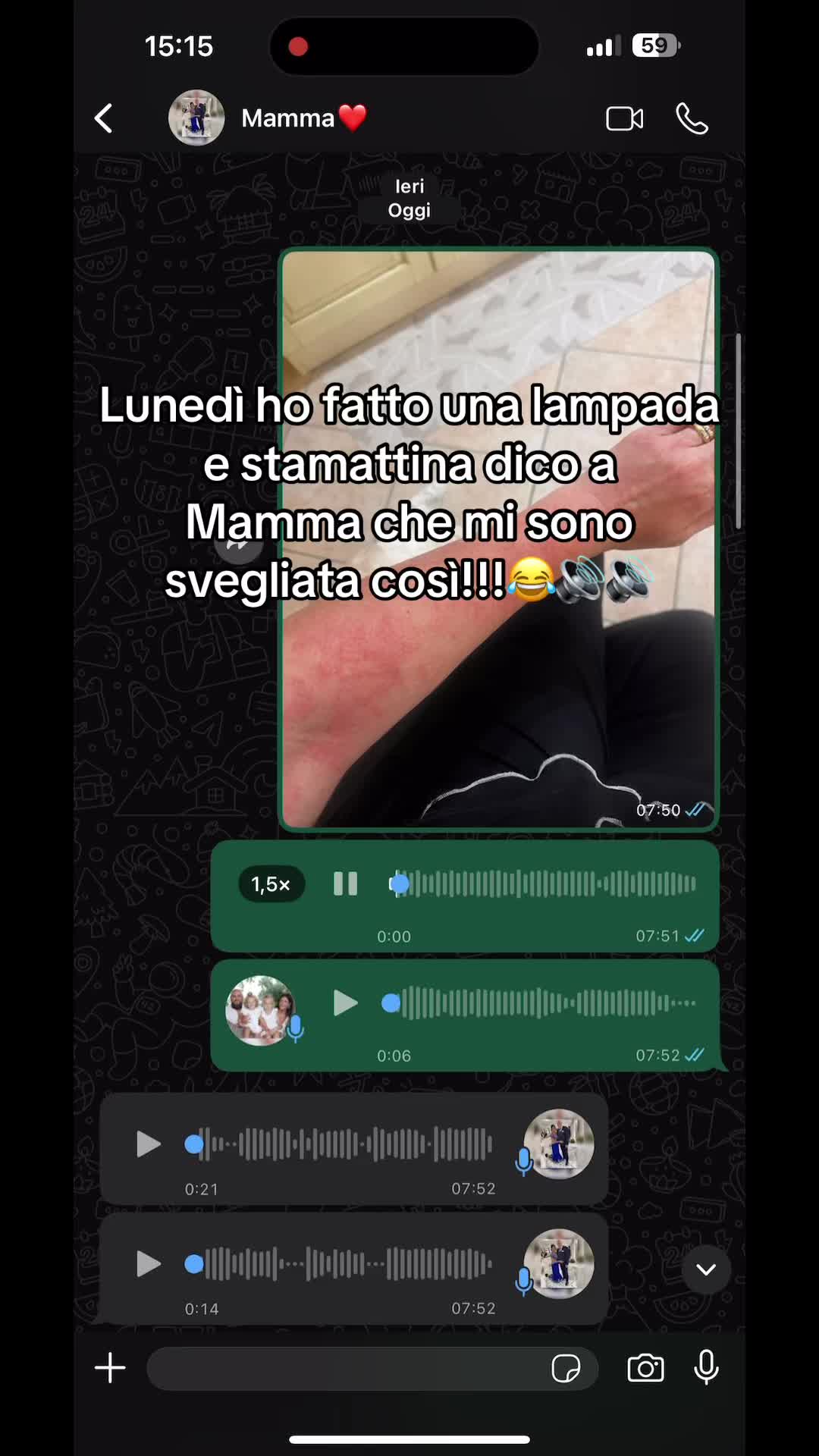 @Antonio Cinzia