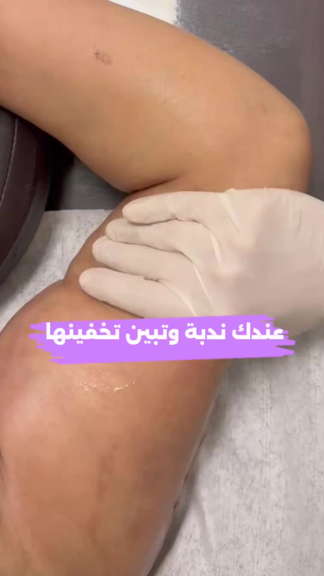 @لايف ستايل HBR 💚