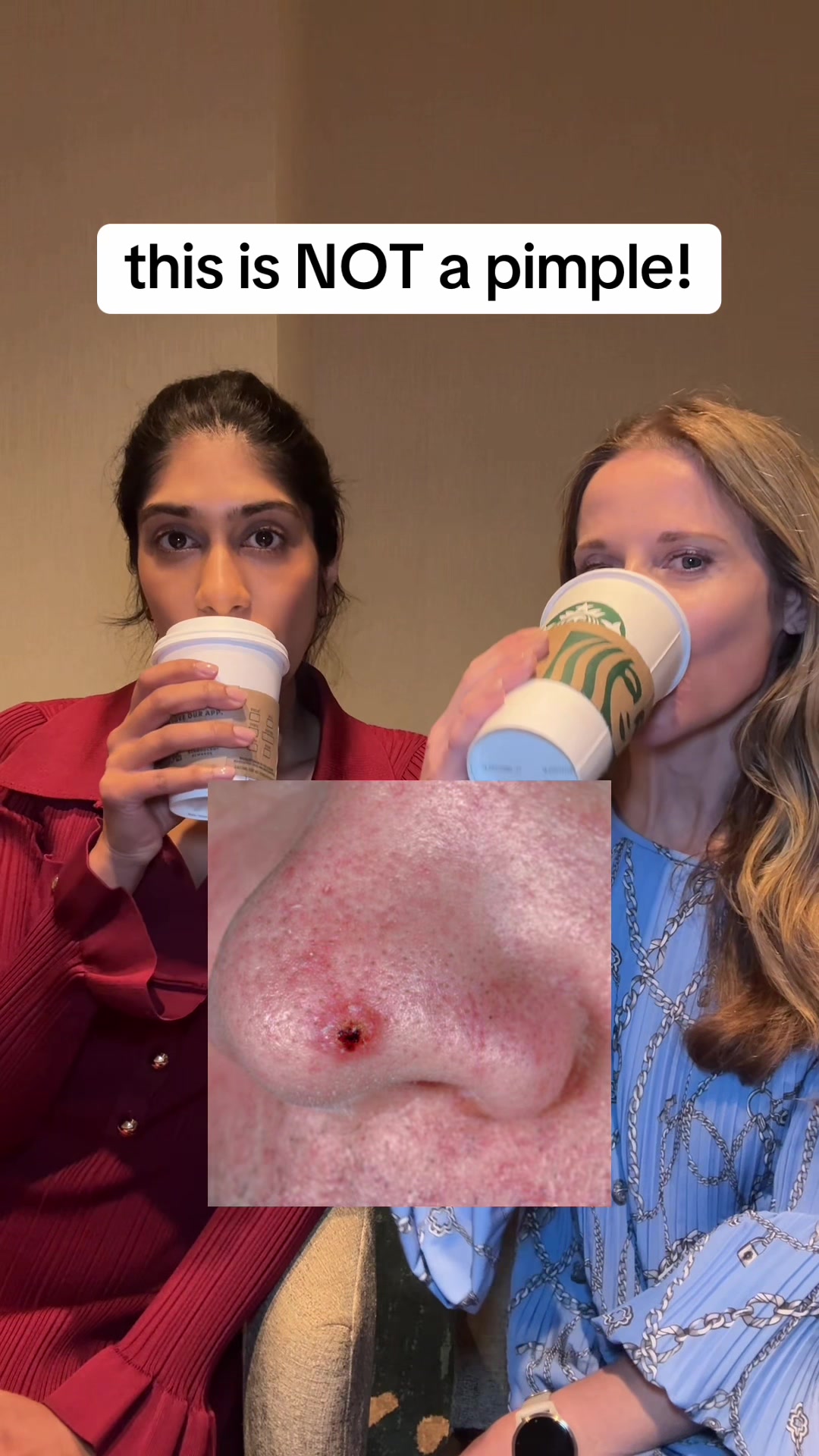 @Dr. Neera, Skin Surgeon