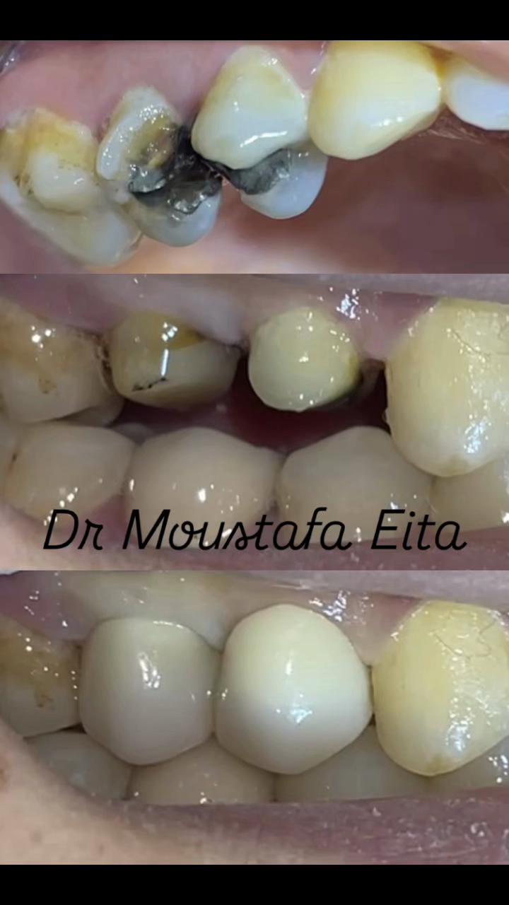 @Dr Mostafa Eita