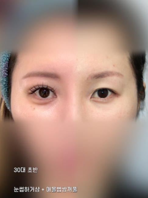 @다시피움성형외과 DASIPIUM タシピウム