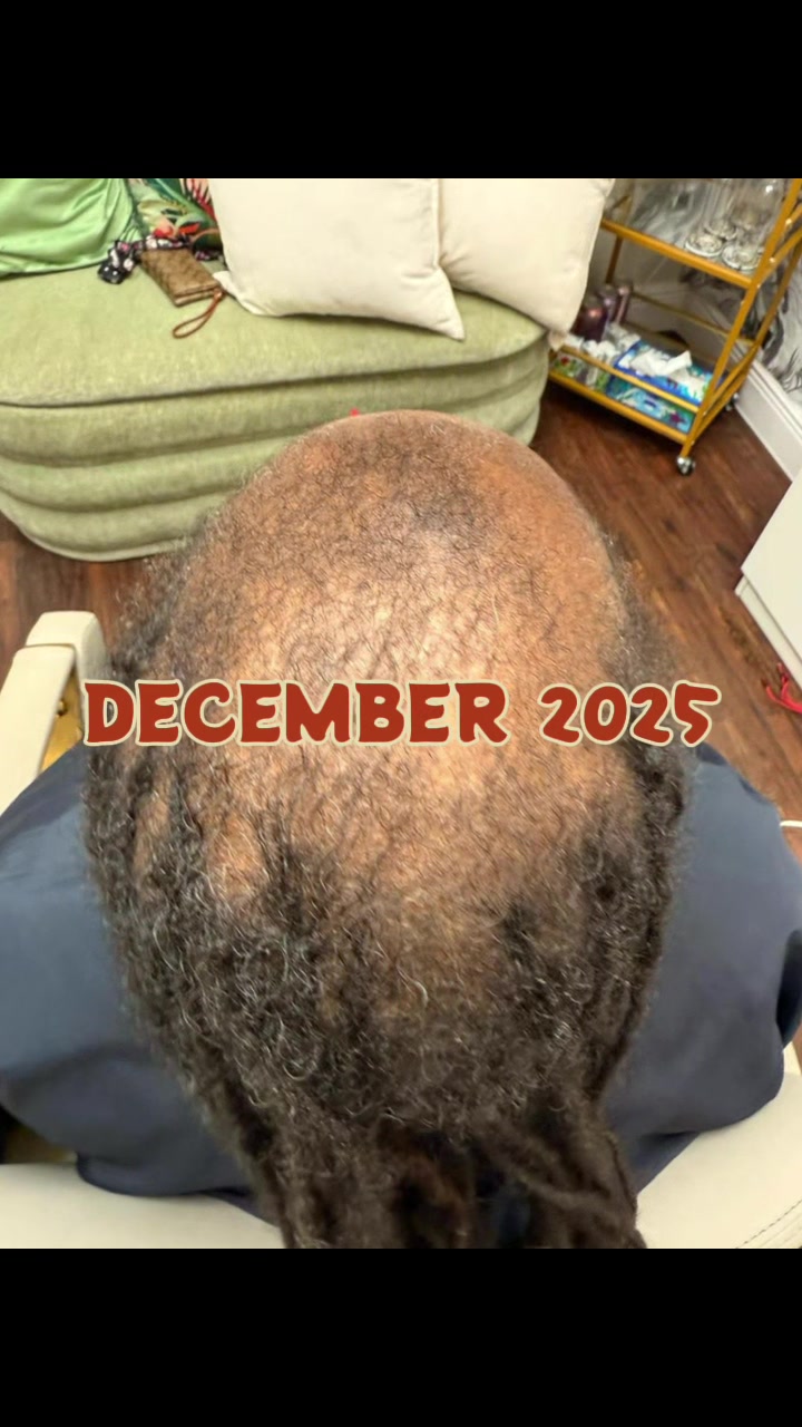 @Akua