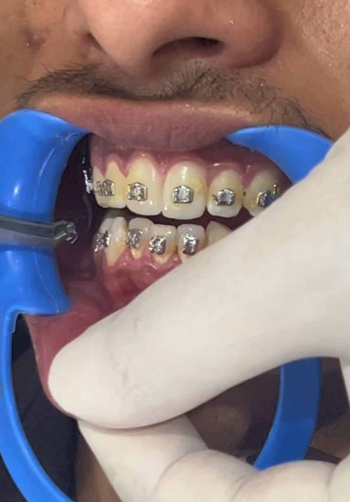 @Smile Dental Studio