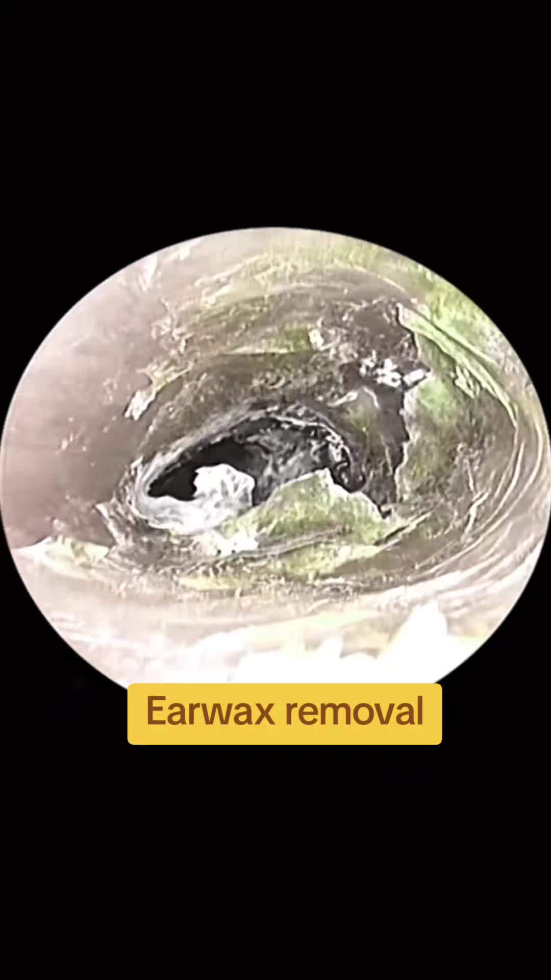 @Earwax.pro