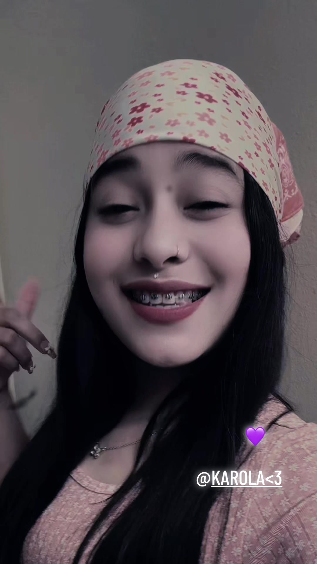 @𝑳𝒂🐒𝑴𝒐𝑵𝒂🐒🥷🏿🫆🇨🇺🍒