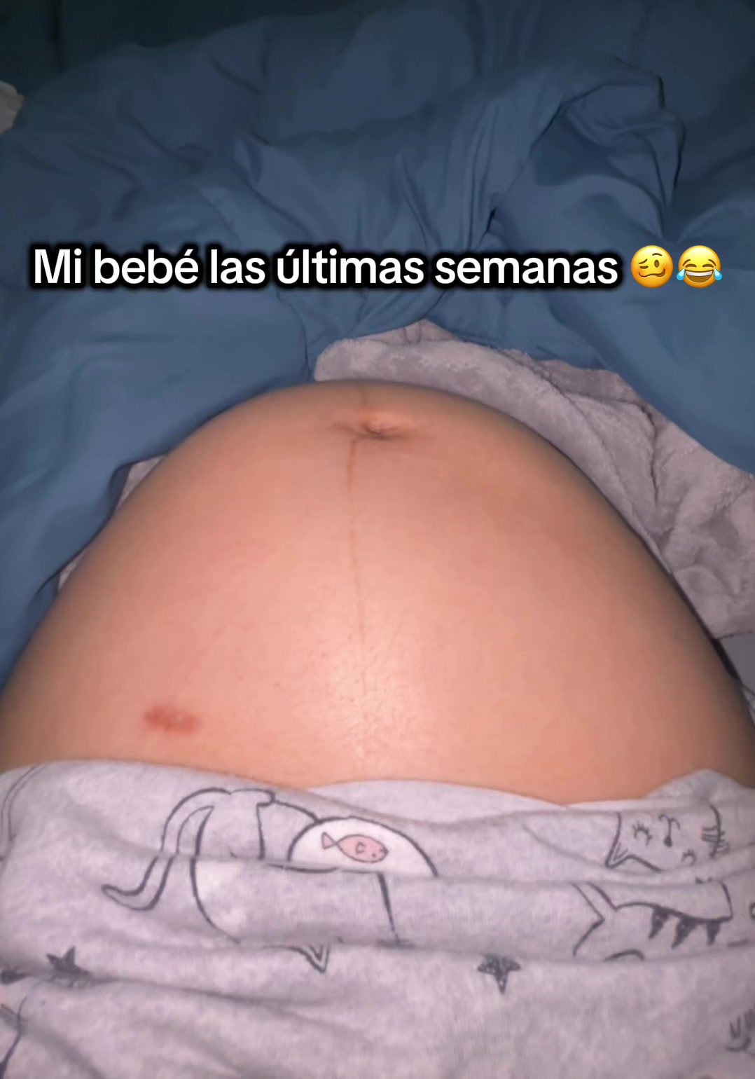 @yirelisz