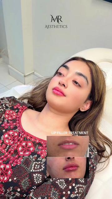 @MR Aesthetics ๐ 0325 9611110