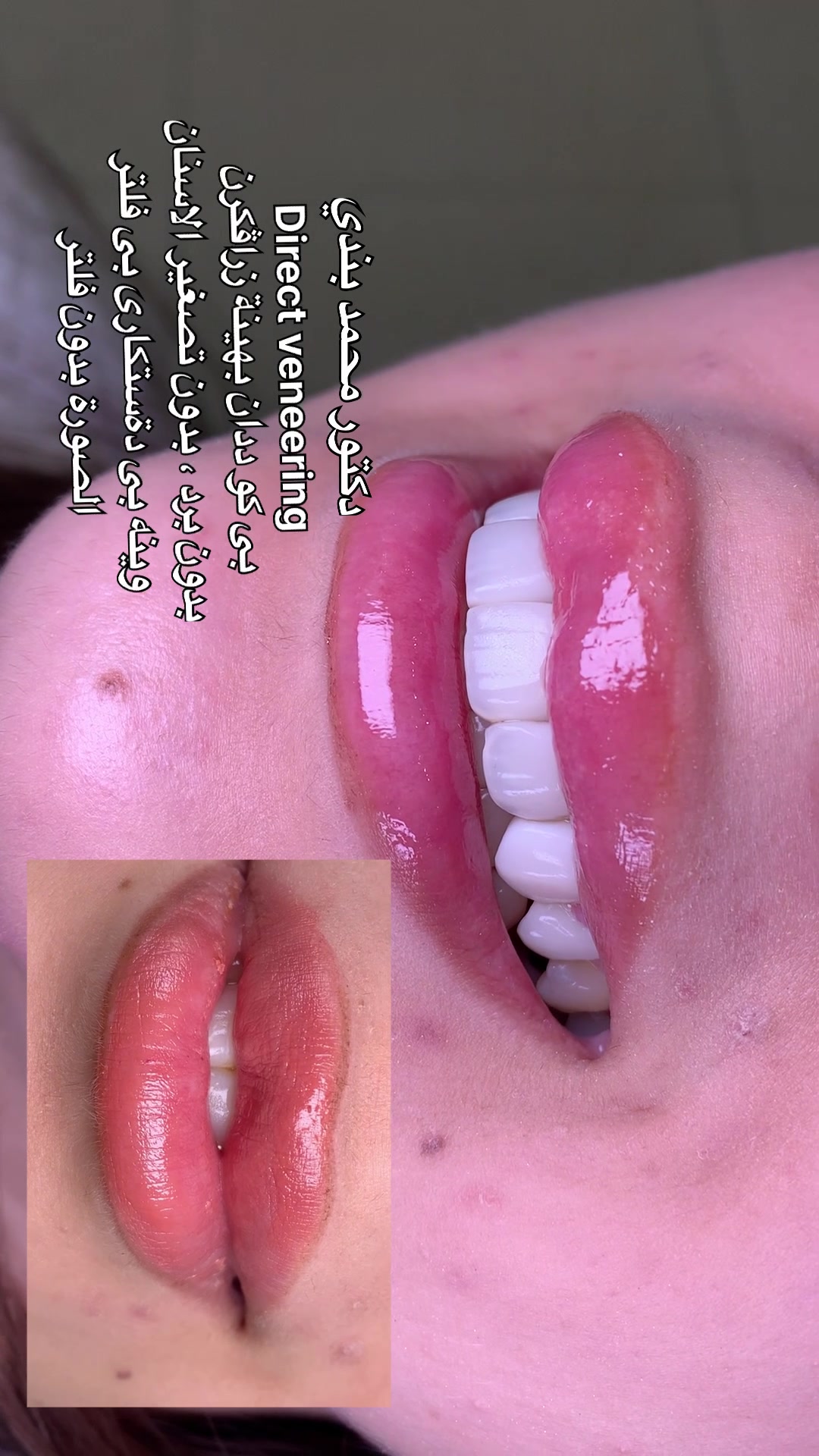 @Dr.Mohammed.Bandi