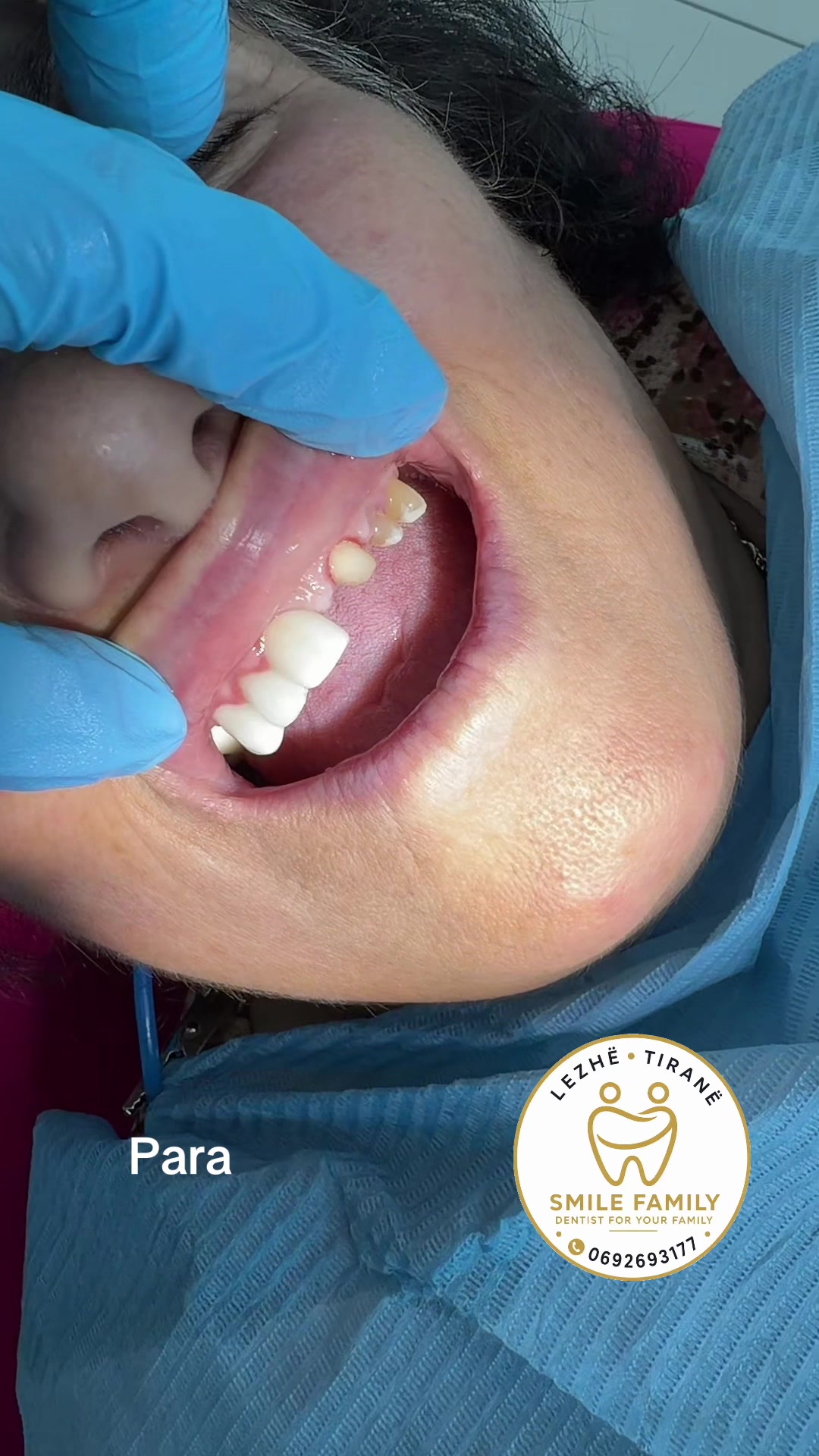 @Smile family_albania