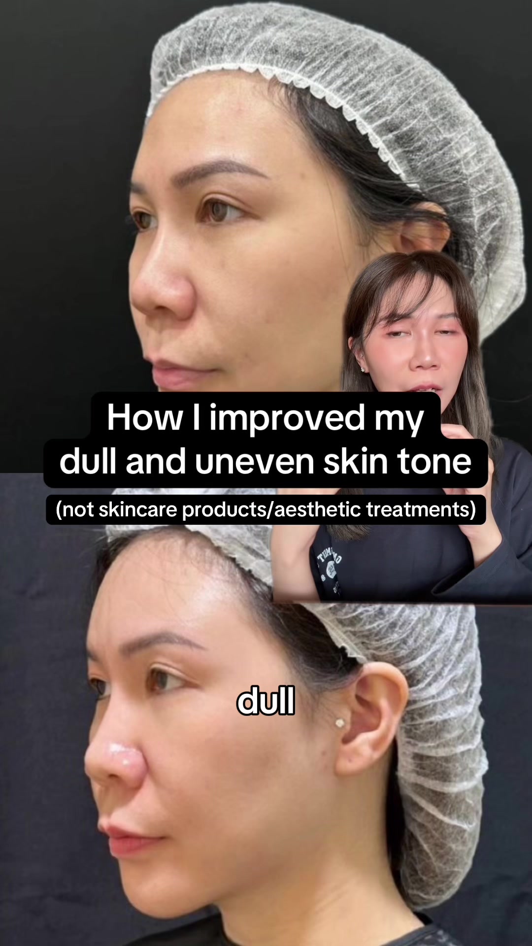 @watermelyn | skin+life