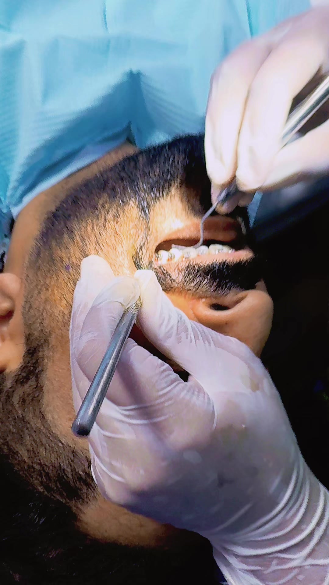 @Dr RahmatullahDental surgeon