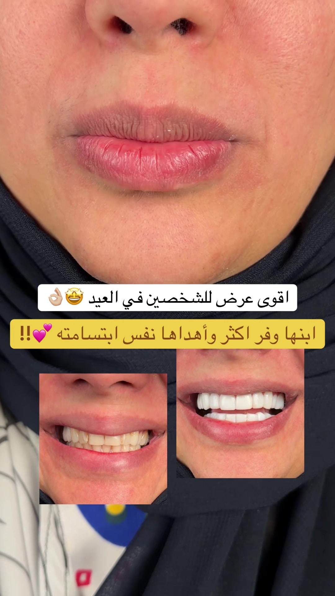 @Dr.lina_almasmoum