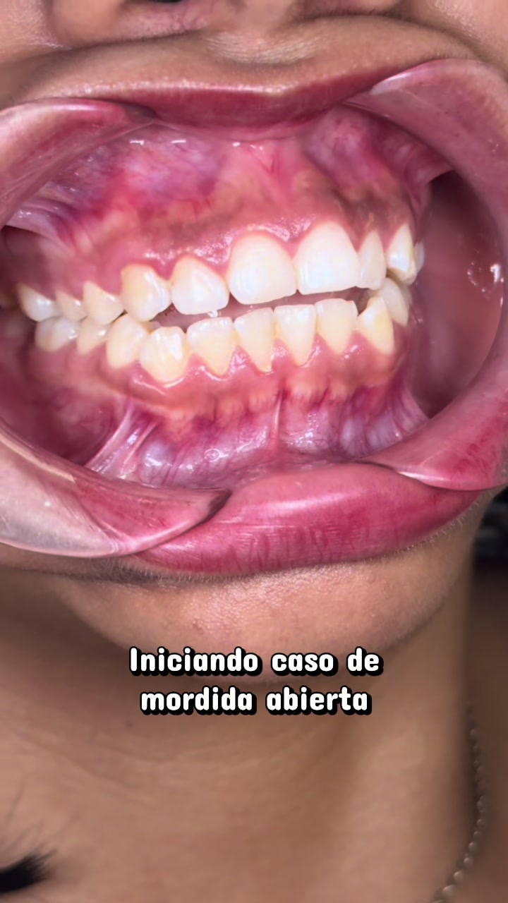 @Dr. Juan Perez | Ortodoncista
