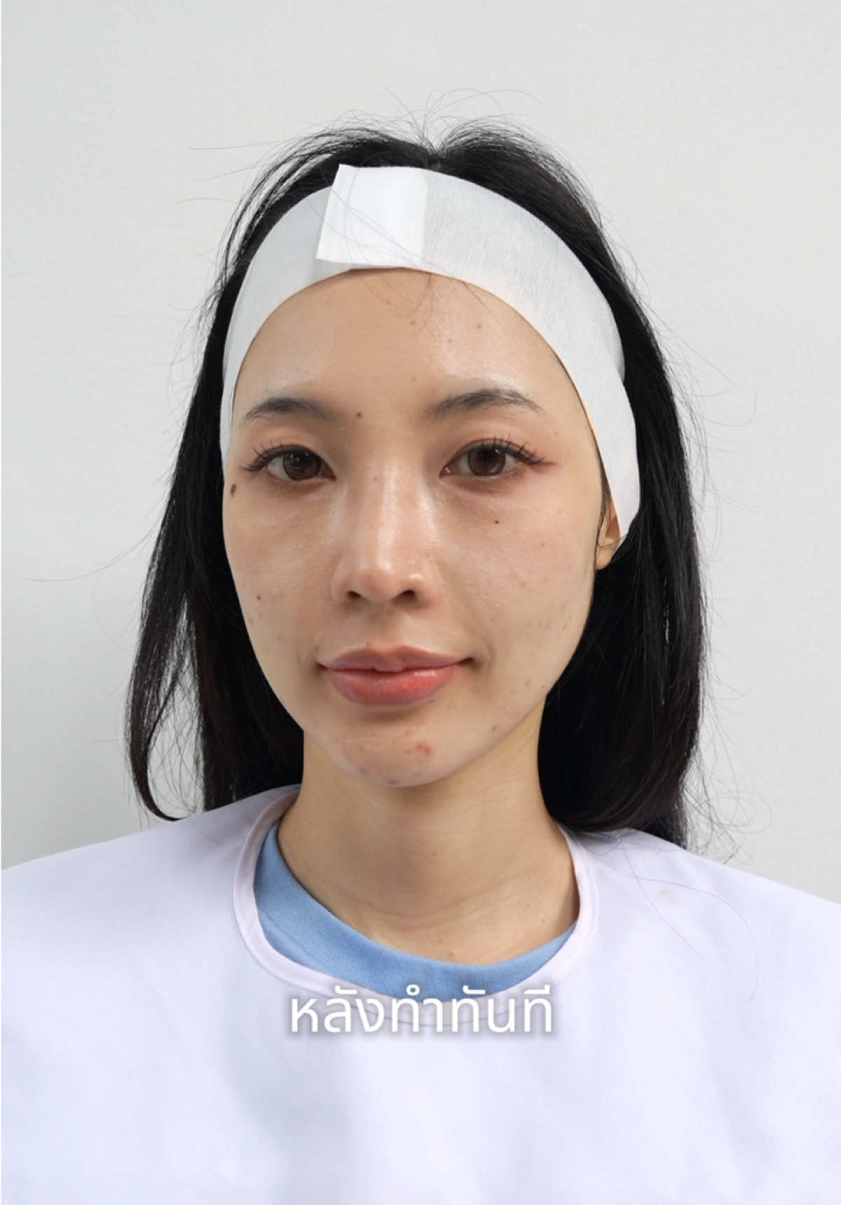 @Standard Skin clinic