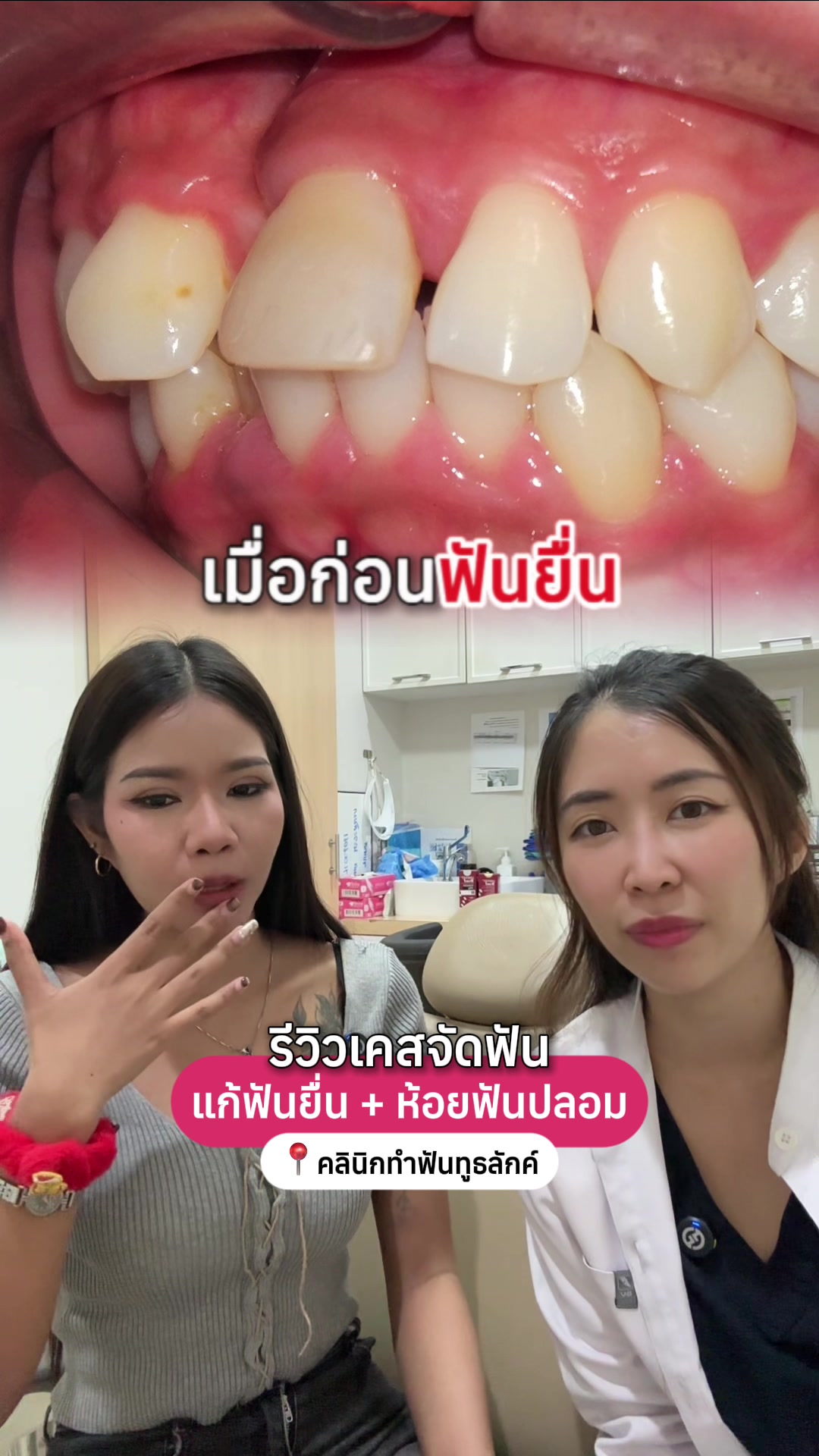 @ณัฐคุณ (Nuttakul Dent) 🦷