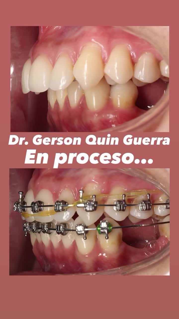 @Dr. Gerson Quin Guerra, PhD