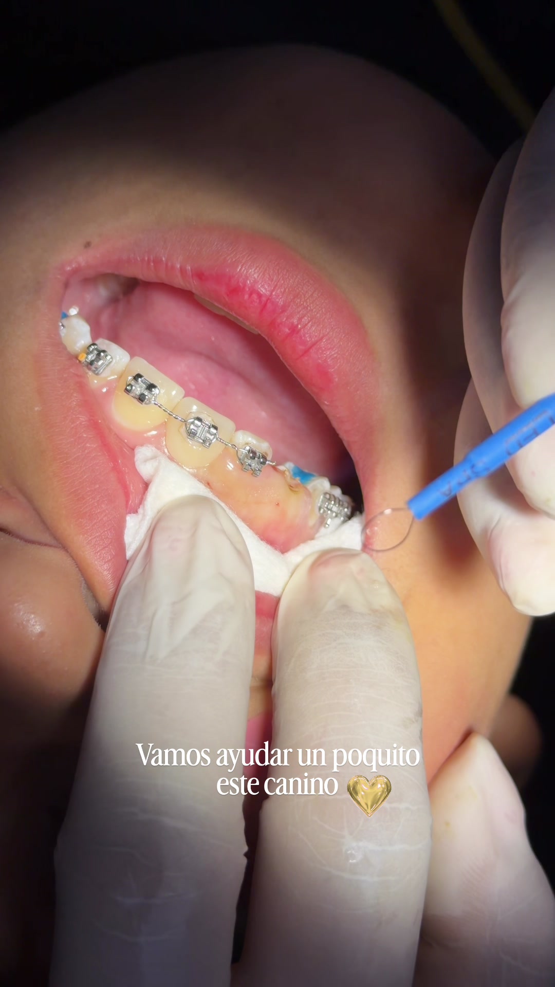 @Dralizbonilla