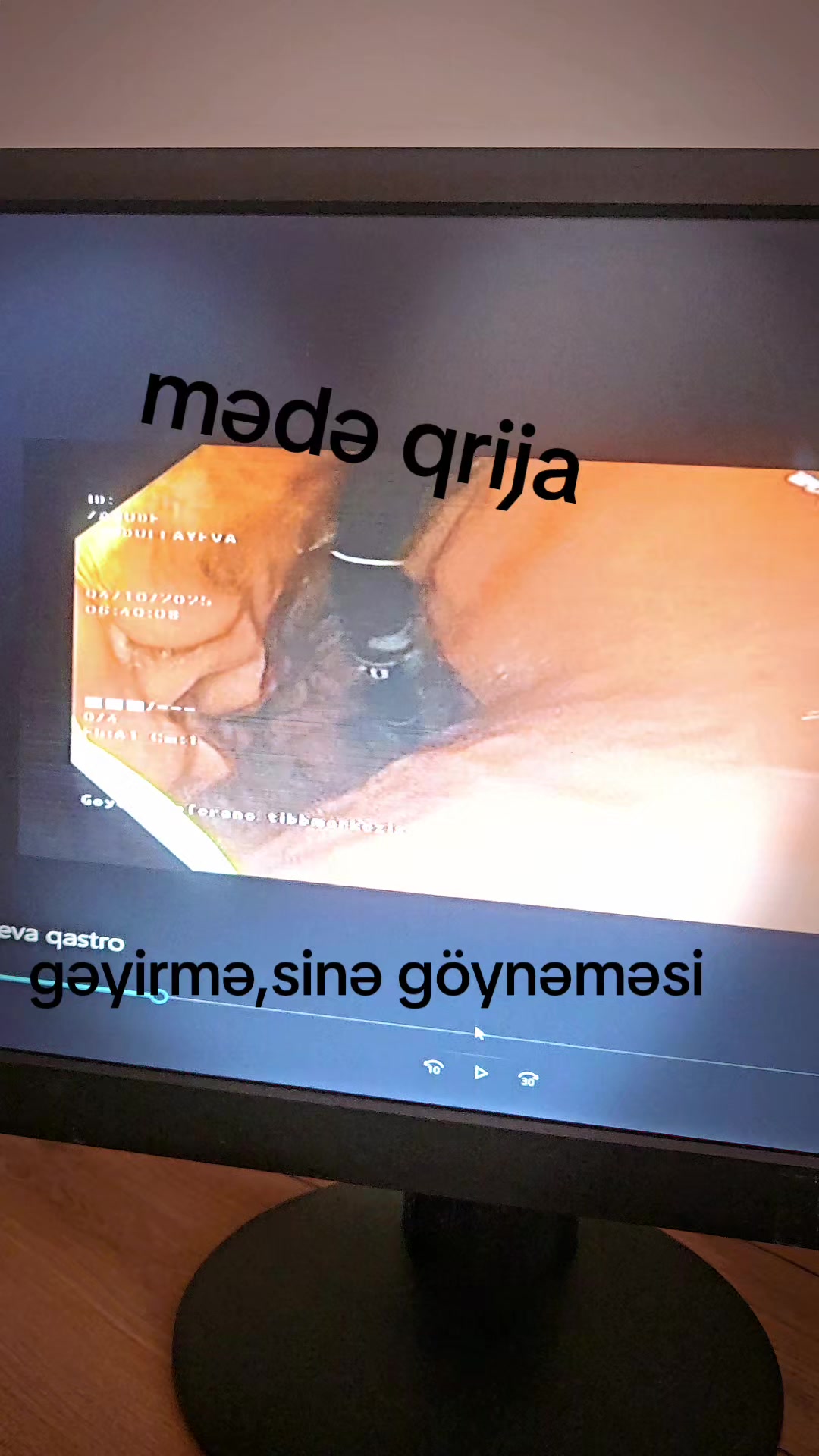 @Leman Xasayeva