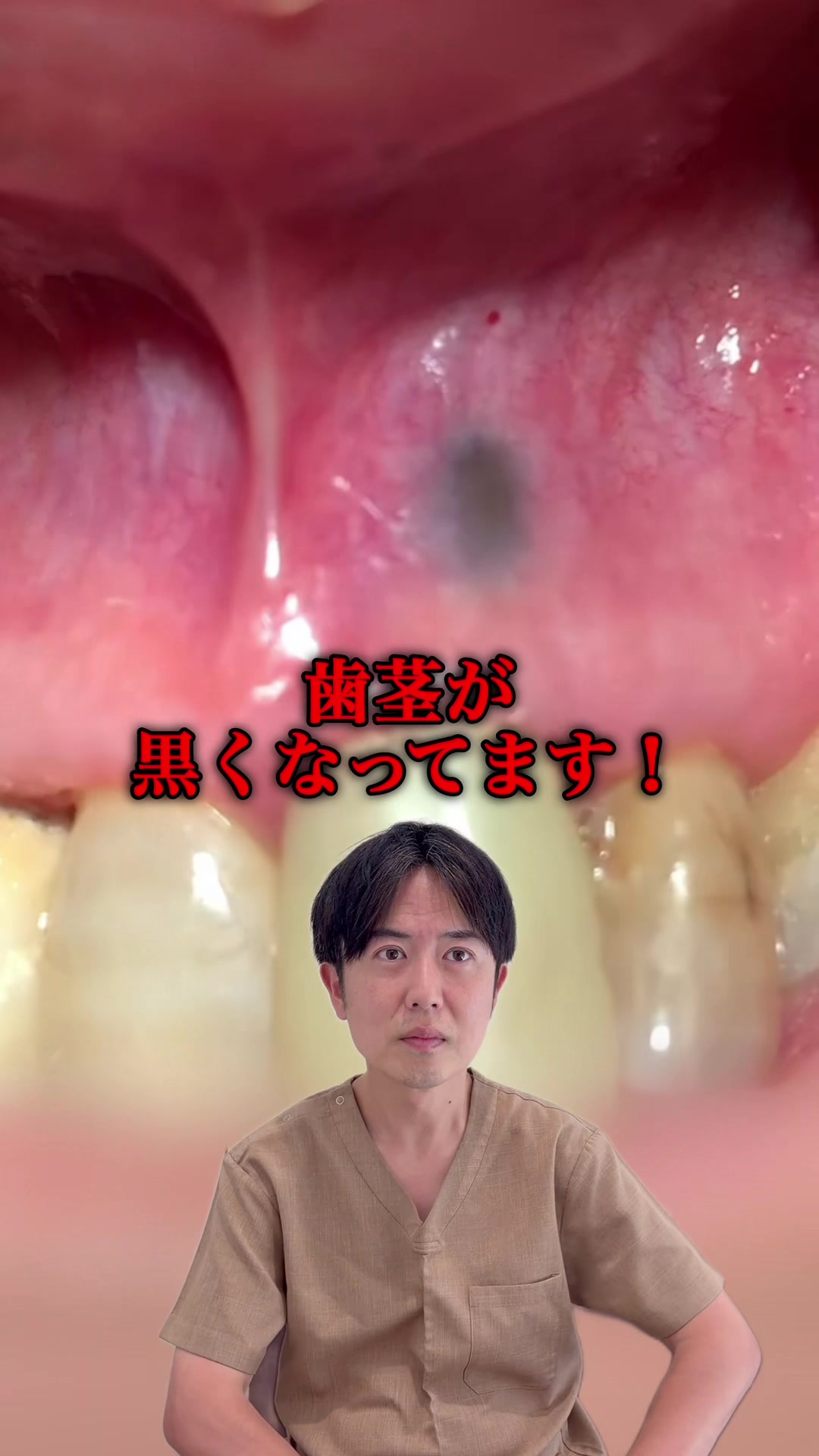 @Dr.山元(湘南歯科クリニック心斎橋院)
