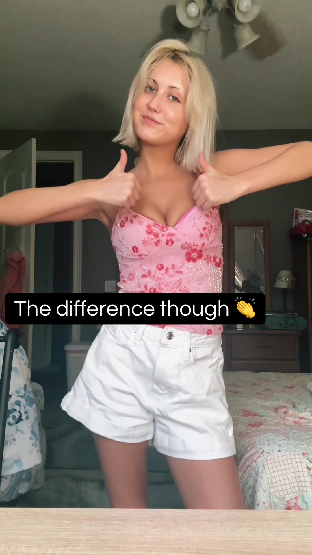 @hypermobilitydiaries