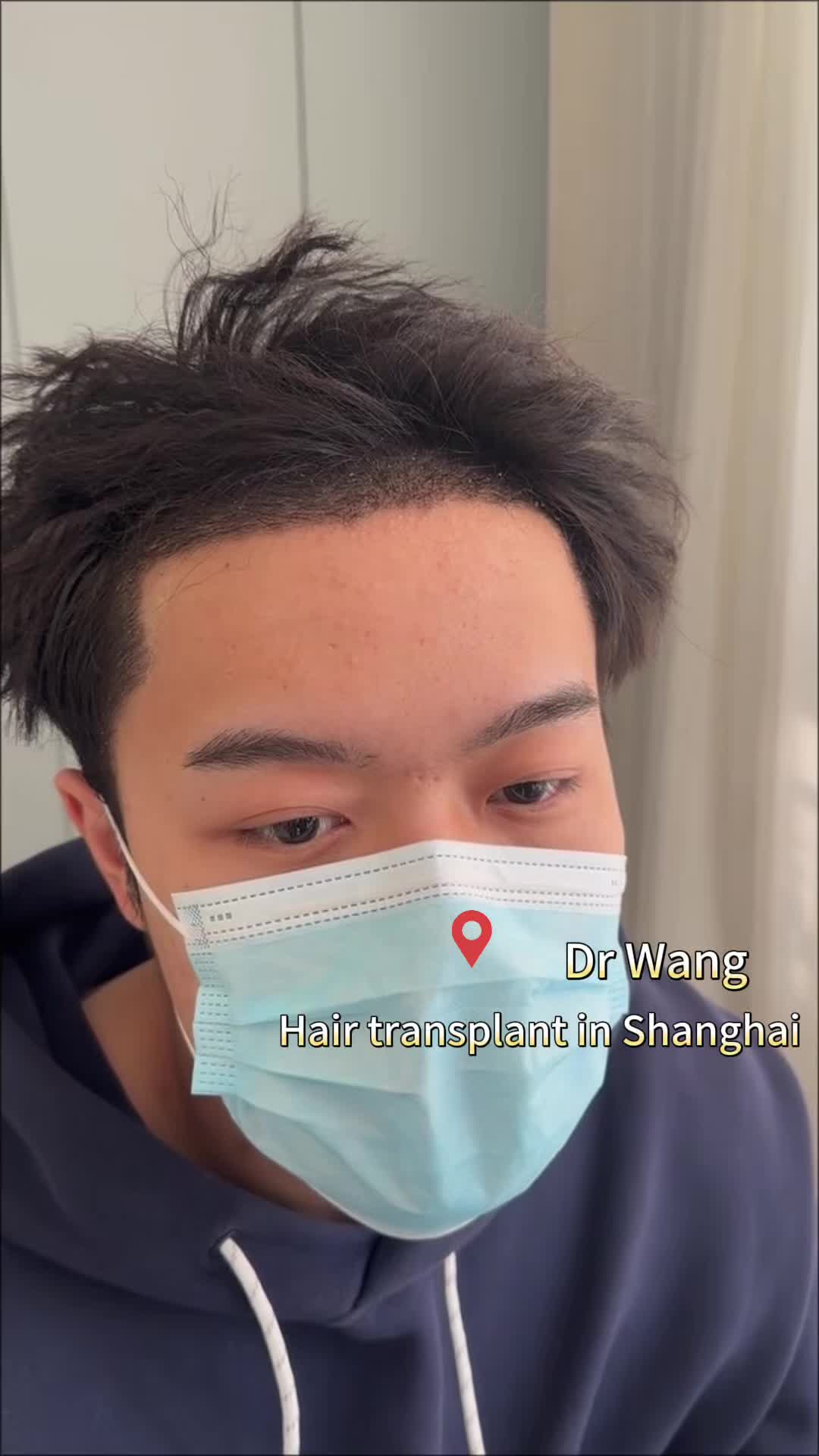 @HAIR TRANSPLANT WANG🇨🇳