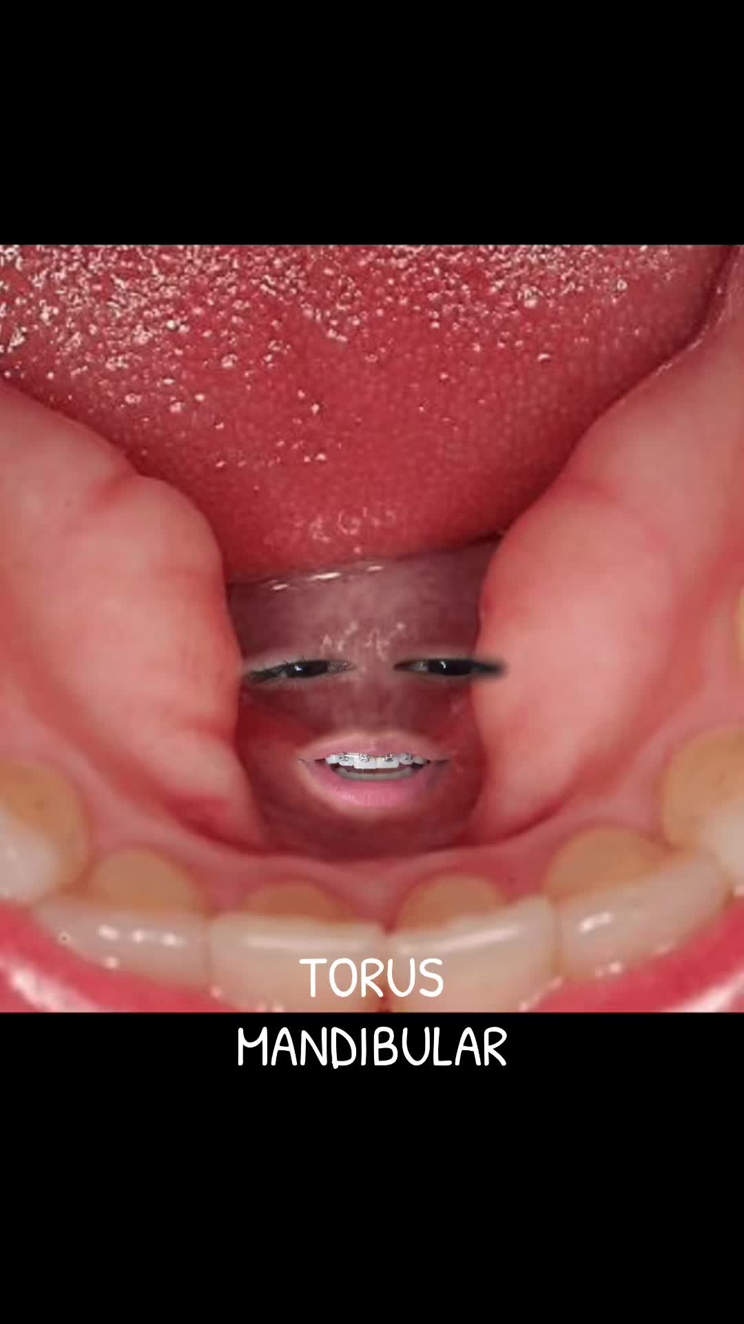@Dental Vanydent