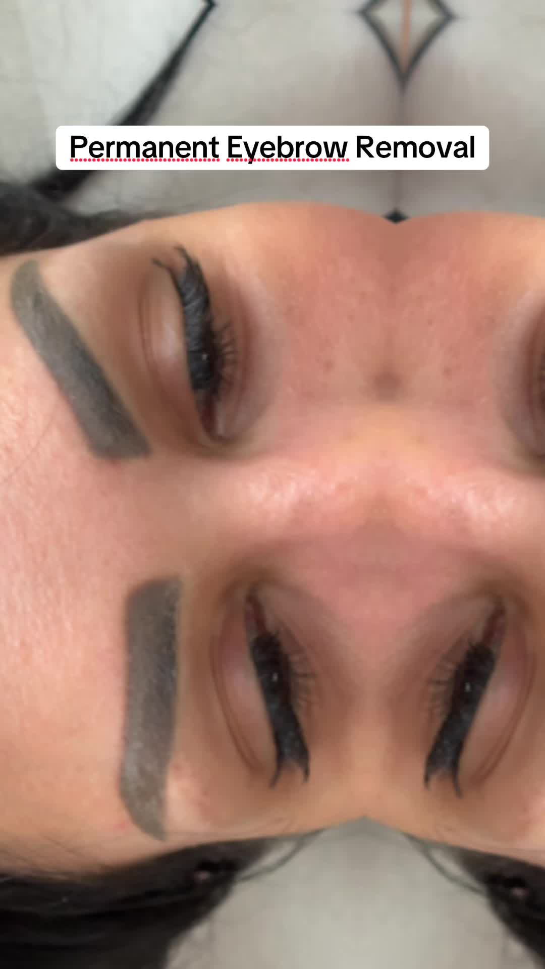 @Permanent Makeup & Removal