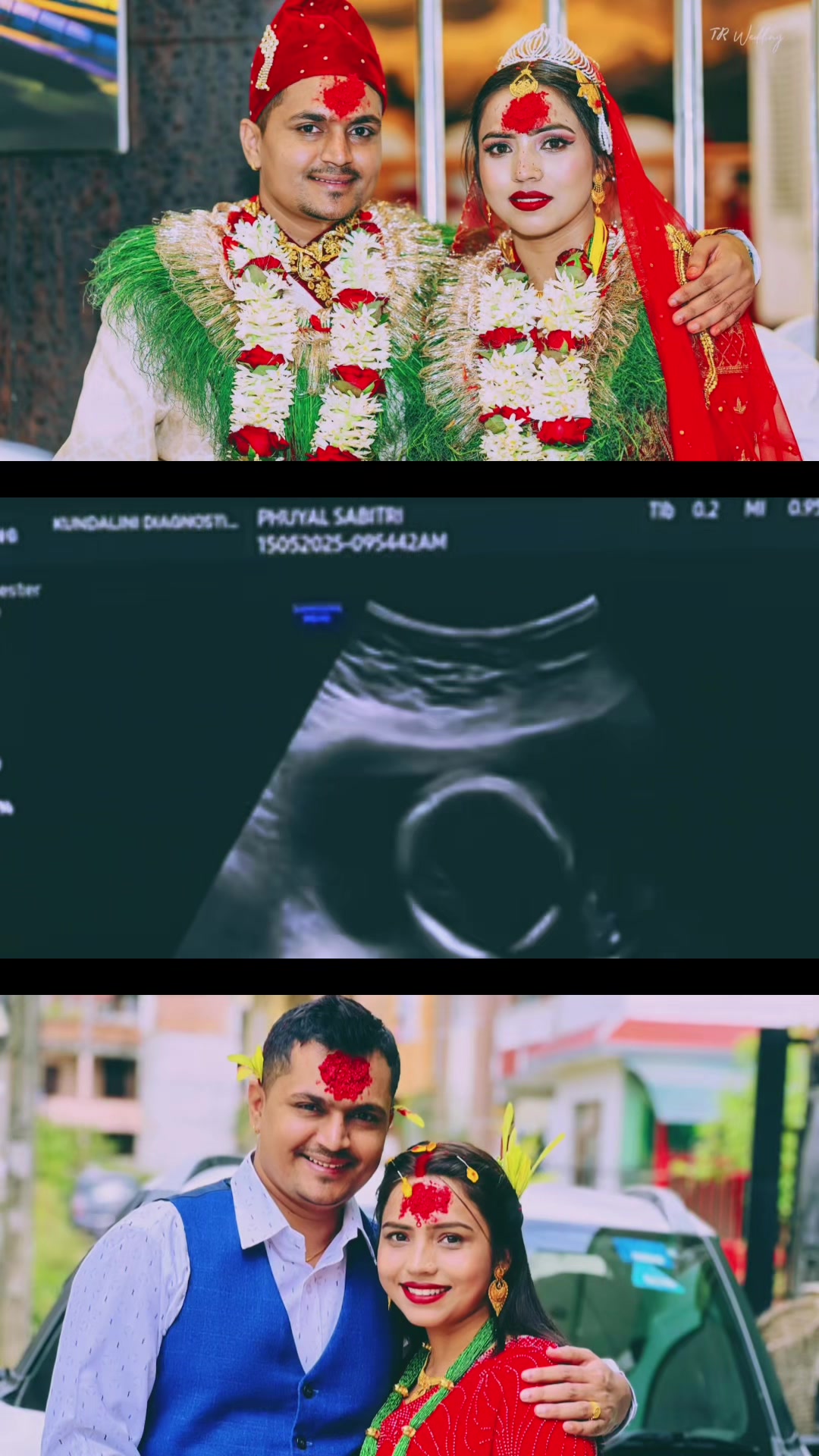 @Kalyan Bhattarai