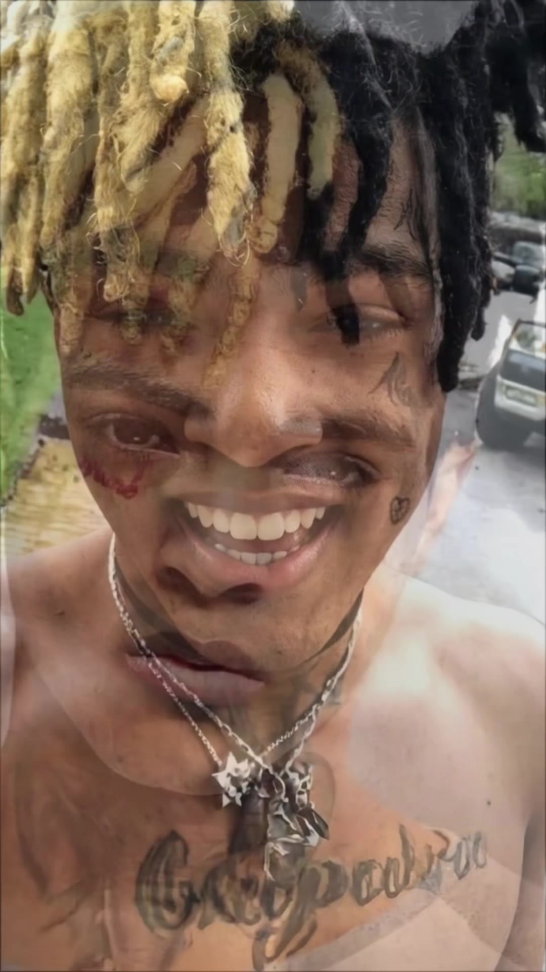 @STEPHEN EDITZ