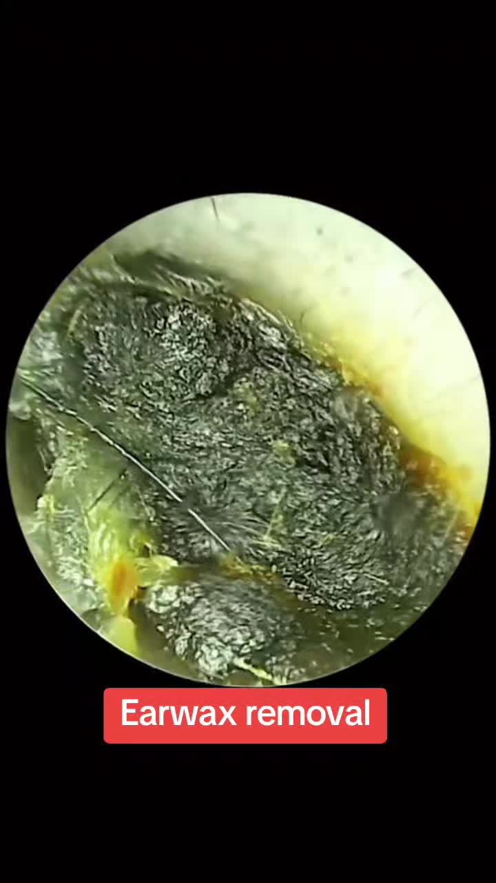 @Earwax.pro