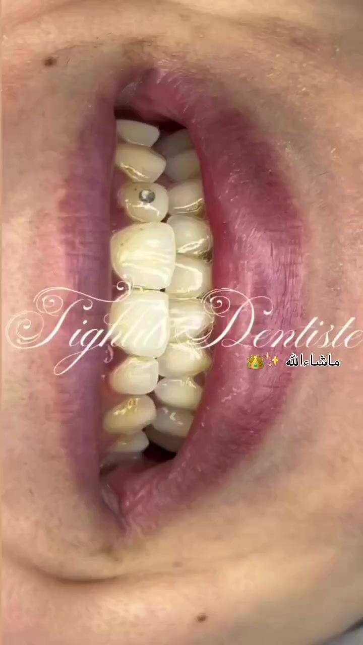 @tighlit_dentiste🦷