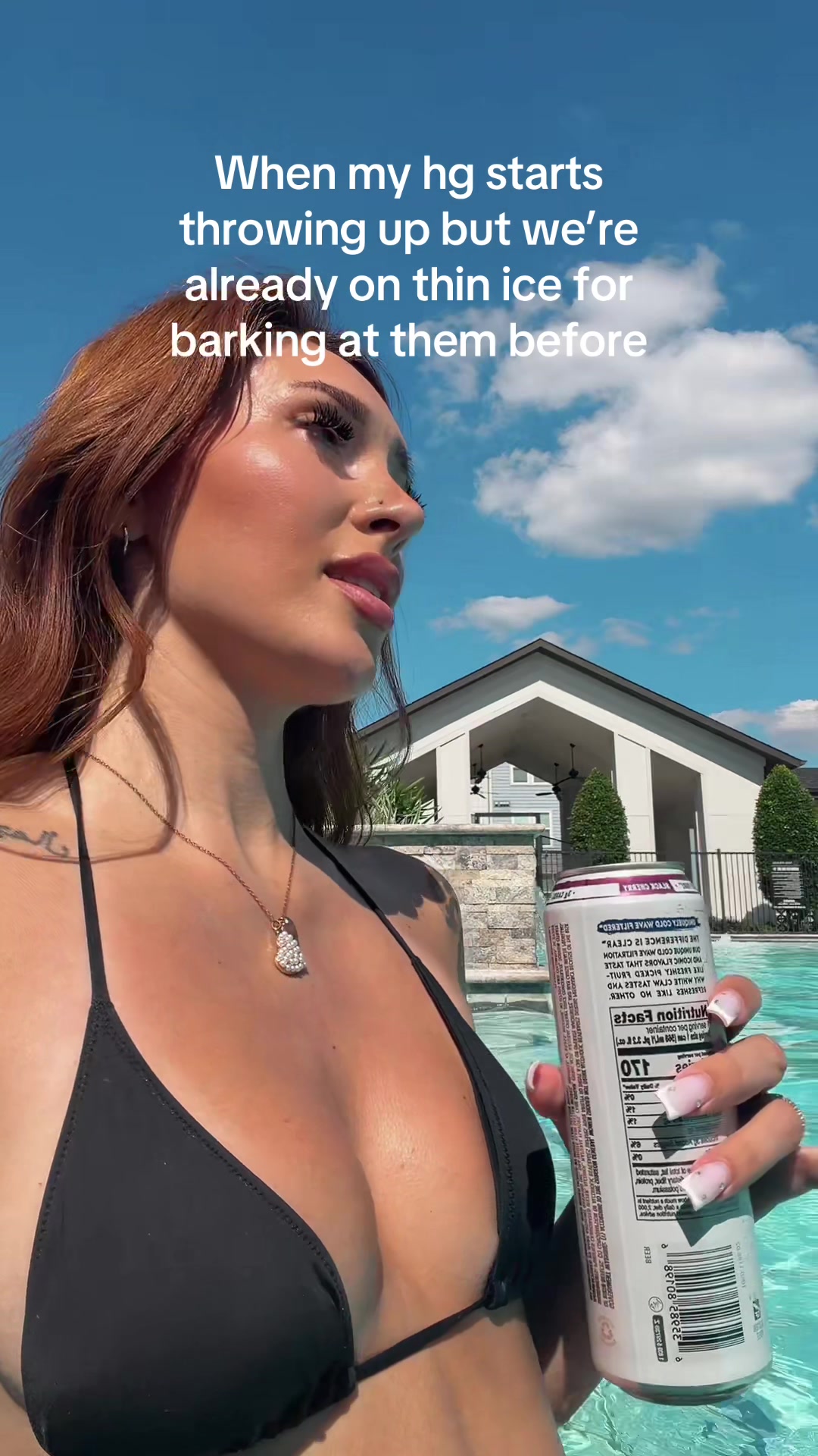 @Zoe