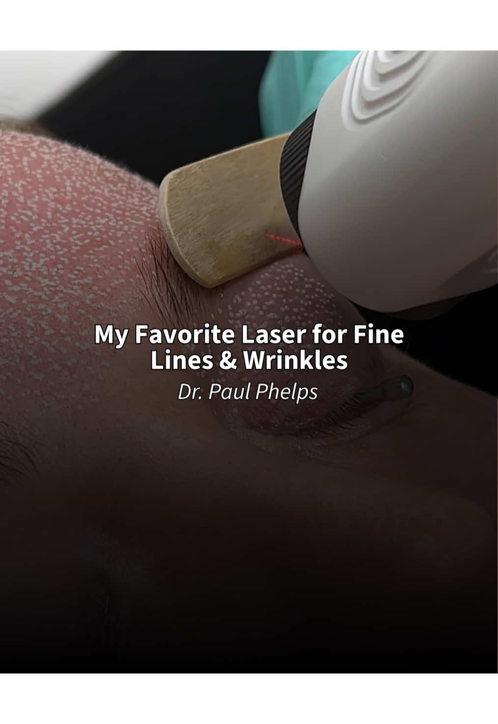 @Paul Phelps, MD