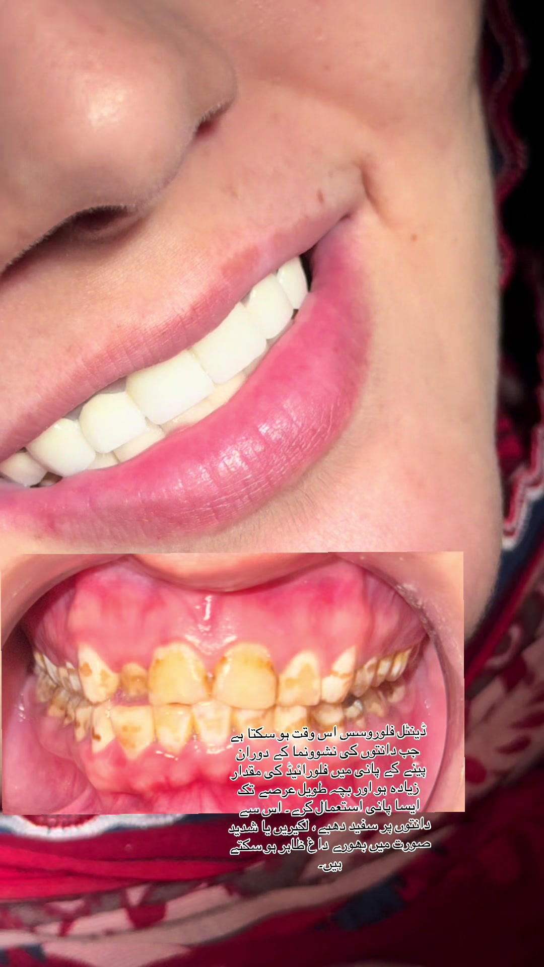 @Dr Hammad| Dental Surgeon