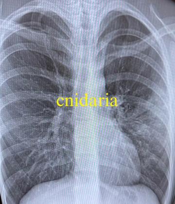 @CNIDARIAskating