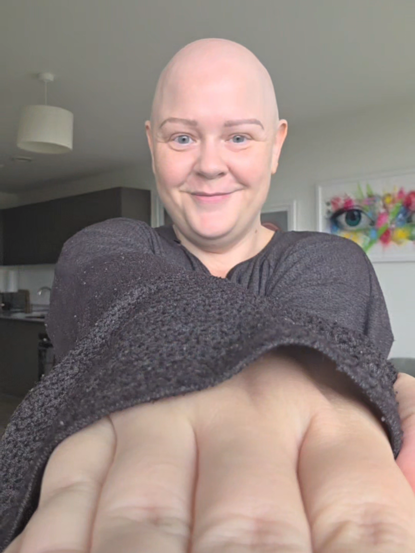 @Bald Beaut ๐