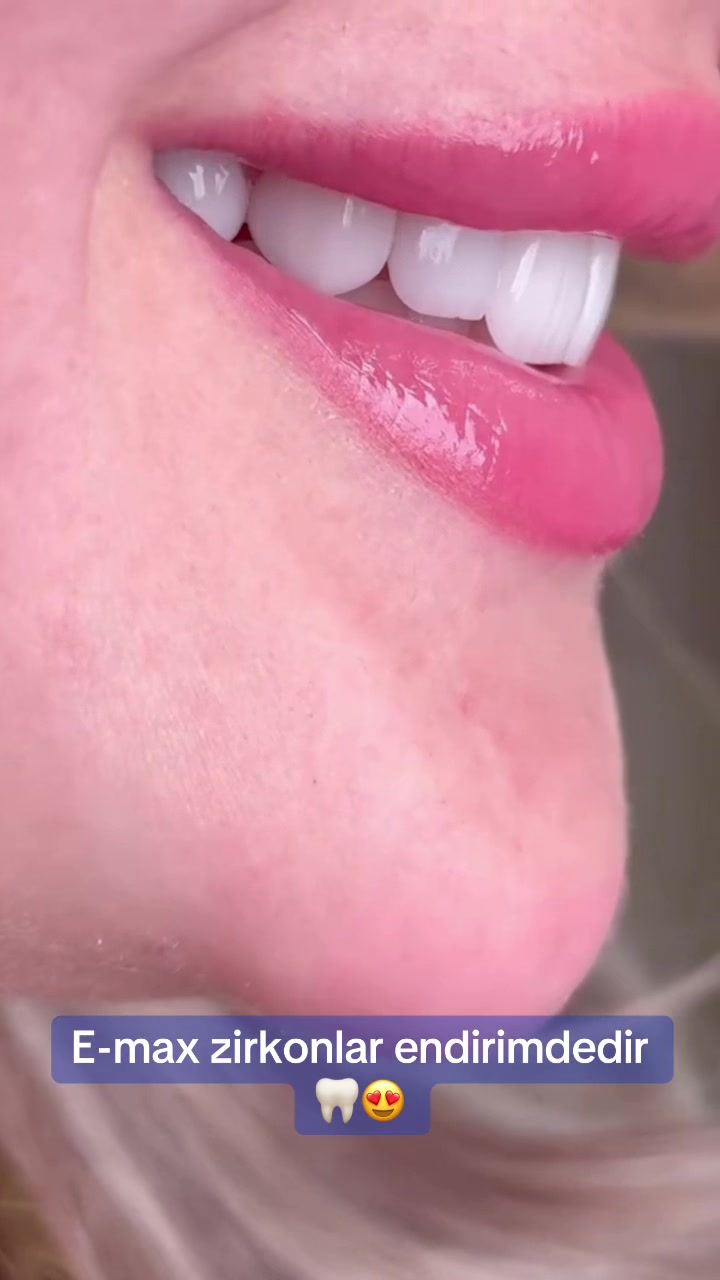 @𝐁𝐚𝐲𝐃𝐞𝐧𝐭𝐄𝐥𝐢𝐭𝐞🦷