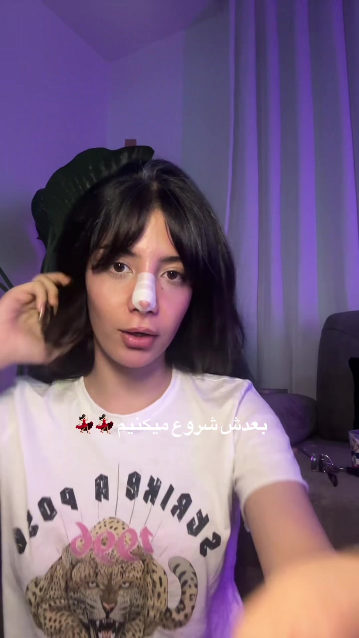 @2ys